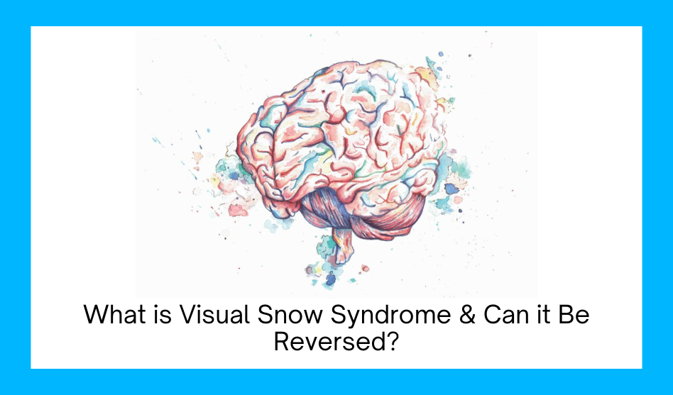 What is Visual Snow Syndrome & Can it Be Reversed?